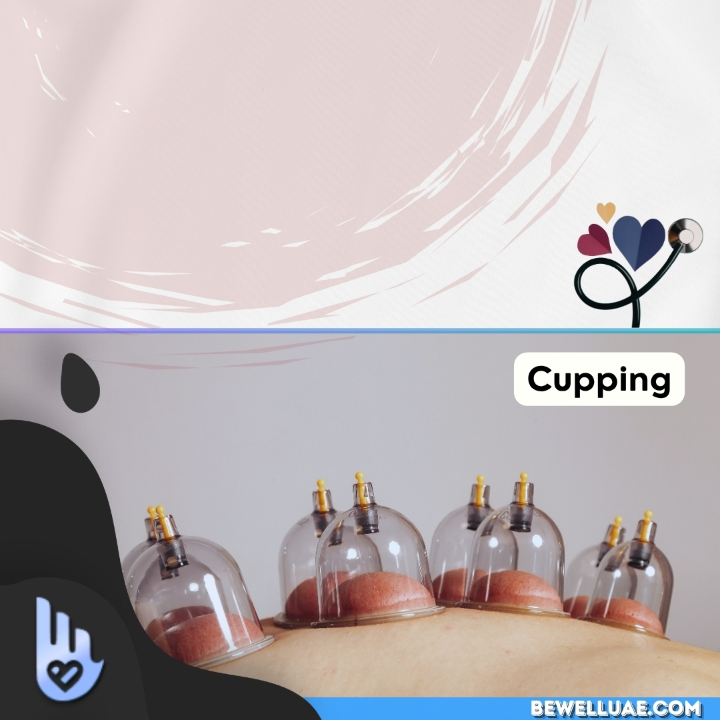 Hijama